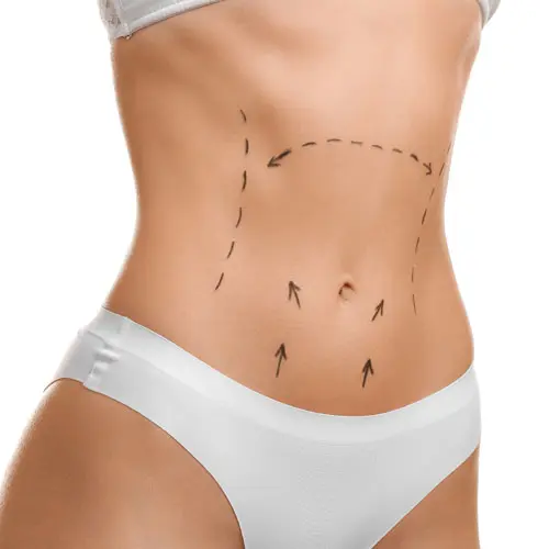 abdominoplasty-costs-egypt